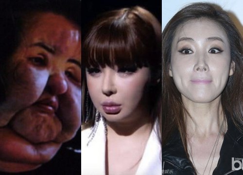 Những ca dao kéo thất bại của người đẹp xứ Hàn: Từ mỹ nhân vạn người mê trở thành thảm họa, có người mua dầu ăn về tự tiêm và cái chết bí ẩn