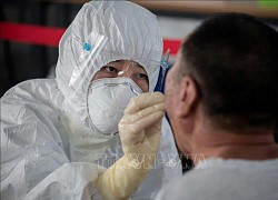 Trung Quốc phát hiện virus SARS-CoV-2 trên bao bì phụ tùng ô tô