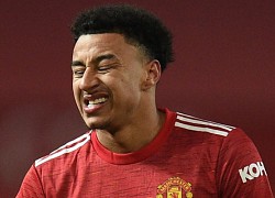 Sự nhố nhăng khiến Lingard lụn bại ở Man Utd