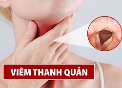 Mùa lạnh, dễ xuất hiện viêm thanh quản cấp