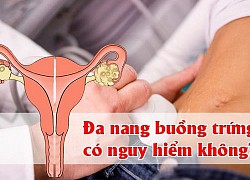 Biến chứng do đa nang buồng trứng