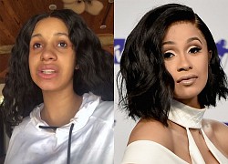 Cardi B nổi cáu vì mụn đầu đen nổi đầy trên mặt: "Thật là khó chịu"