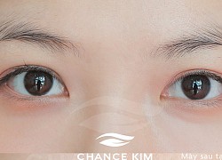 Chance Kim Brows - thương hiệu hàng đầu trong công nghệ tạo sợi lông mày phong cách tự nhiên