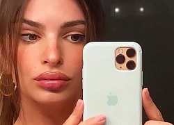 Emily Ratajkowski phủ nhận tin đồn bơm môi