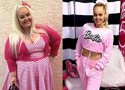 Nàng béo 154kg phẫu thuật cắt bỏ 80% dạ dày, lột xác kinh ngạc để giống búp bê Barbie