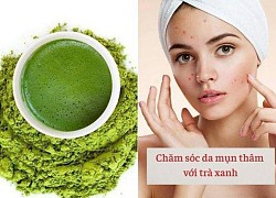 Những bí quyết phải nằm lòng khi chăm sóc da mụn, nàng làm theo Tết này da căng bóng