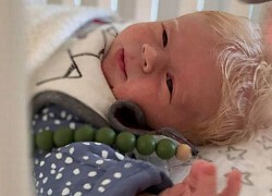 Kỳ lạ em bé sinh ra có mái tóc trắng như tuyết