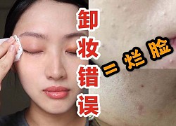 Tẩy trang theo cách này thì đừng hỏi tại sao da lên mụn, chảy xệ và lão hoá