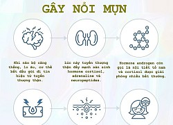 Vì sao stress khiến da nổi mụn