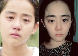 "Em gái quốc dân" Moon Geun Young lão hóa không phanh ở tuổi 34, fan lo lắng do ảnh hưởng tâm lý vì "không nơi nương tựa"