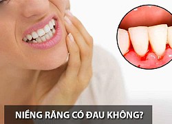 Tẩy trắng răng có hại gì với sức khỏe và những đối tượng không nên tẩy