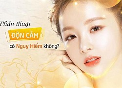 Độn cằm V Line là gì? Độn cằm có đau và nguy hiểm không?