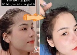 Dùng B5 để ủ tóc: Cô nàng này bất ngờ vì tóc con mọc tua tủa, đỡ hẳn trán hói