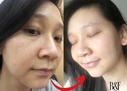 Học phụ nữ Nhật uống collagen mỗi tối trước khi đi ngủ, làn da nàng BTV 30 tuổi biến đổi bất ngờ