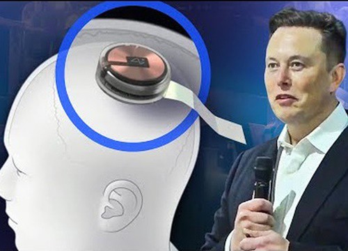 Elon Musk sắp cấy chip vào não người, giúp người liệt đặt hàng online, lướt web bằng sóng não