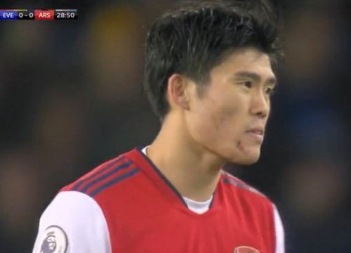 Tomiyasu bị giẫm thô bạo vào mặt, quyết định của trọng tài khiến fan Arsenal phẫn nộ