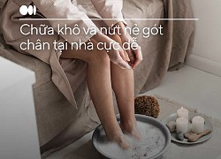 5 lợi ích không ngờ tới của giấm: Tạm biệt mùi hôi, nứt nẻ, quá lãi để đầu tư