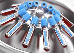 &#8216;Cập nhật lại vaccine&#8217; để ngăn chặn biến thể Omicron