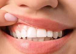 4 bệnh có thể xuất hiện dấu hiệu ở răng