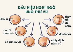 Bạn có biết yếu tố nào có thể gây ung thư vú?