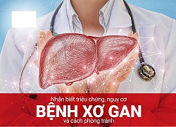 Xơ gan và chảy máu thực quản