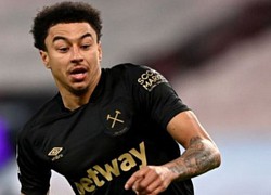 'Lingard còn trẻ'
