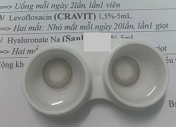 Nữ sinh tố dùng lens của thương hiệu nổi tiếng bị viêm kết mạc, yêu cầu hoàn tiền 320k nhưng không được giải quyết