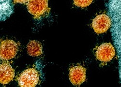 Vì sao biến chủng của virus SARS-CoV-2 xuất hiện ngày càng nhiều và nguy hiểm hơn?