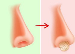 Khi hành động cực quen thuộc trở thành... tự hoại: Đây là 6 lý do để bạn làm gì thì làm, đừng nên ngoáy mũi