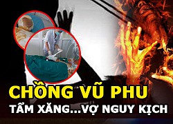 Chồng vũ phu tẩm xăng thiêu vợ nguy kịch &#8211; Gia đình văn hoá?