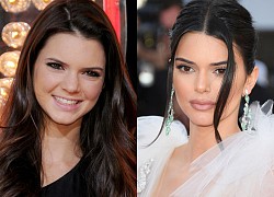 Kendall Jenner chỉnh sửa bao nhiêu điểm trên cơ thể?