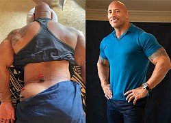 Dwayne Johnson châm cứu sau chấn thương