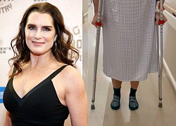 Diễn viên 'Eo biển xanh' Brooke Shields bị ngã gãy xương đùi