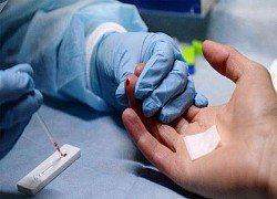 Xử trí khi bị phơi nhiễm HIV