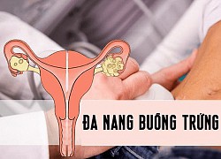 Bệnh lý ở buồng trứng gây khó thụ thai