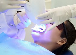 Tẩy trắng răng bằng laser thế nào?