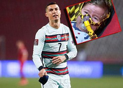 Băng đội trưởng Ronaldo vứt đi mang về 2 tỷ đồng cứu người