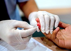 Các triệu chứng của người nhiễm HIV dễ bị nhầm với bệnh cúm