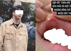 Sốc: Cô gái "phốt" bạn trai đẹp như "hot boy" vũ phu, hành hung bầm tím người vì trai lạ "thả tim"