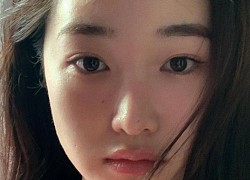 Bật mí cực mạnh 5 tips ngừa thâm đơn giản cho các nàng có đam mê&#8230; nặn mụn, có mẹo chỉ cần thực hiện trong 30 giây!