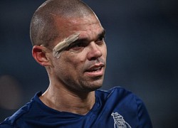 Ngày Pepe làm lu mờ Ronaldo