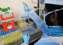 Nghiên cứu: Biến thể của virus SARS-CoV-2 phát hiện ở Anh gây tử vong cao hơn