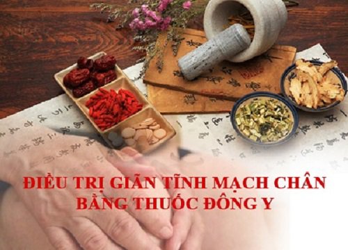 Đông y chữa suy giãn tĩnh mạch chân