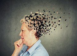 Thuốc mới có thể giúp điều trị bệnh Alzheimer