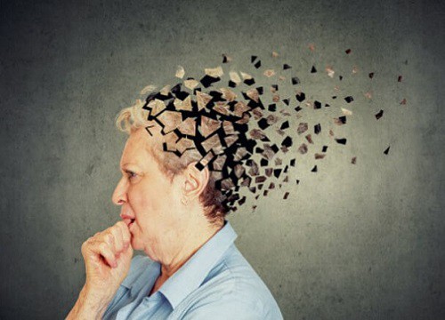 Thuốc mới có thể giúp điều trị bệnh Alzheimer