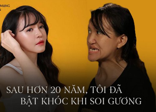 Màn "lột xác" ngoạn mục của cô gái có gương mặt dị dạng: Hơn 20 năm mới tự tin soi gương