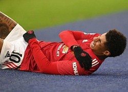 Rashford trì hoãn phẫu thuật tới sau EURO