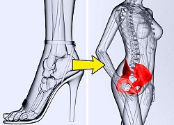 Điều gì xảy ra với cơ thể khi đi giày cao gót mỗi ngày?