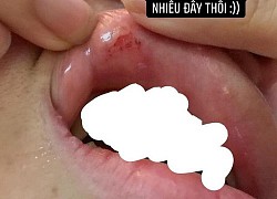 Từ thanh niên 'đào mỏ' đến 'boy phố cổ' đánh đập người yêu sảy thai: Điểm danh loạt bạn trai khiến hội chị em nguyện... không thoát ế!