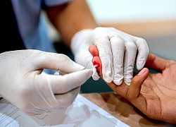 Phương pháp giúp phát hiện chính xác người nhiễm HIV